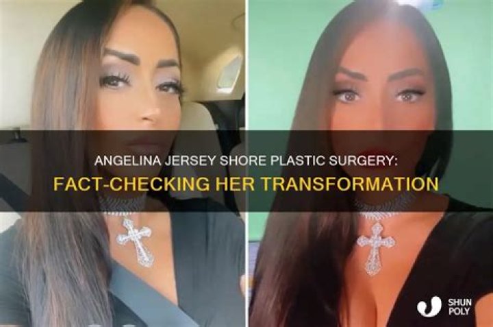 Angelina From ‘Jersey Shore’ Opens up About Getting Plastic Surgery: “I Was Very Insecure” (EXCLUSIVE)