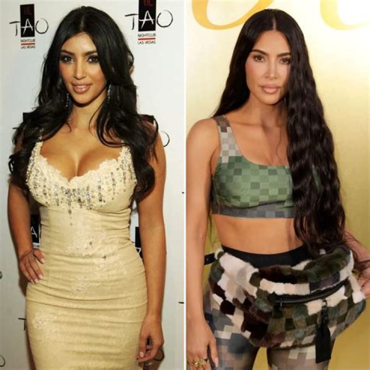 Butt Implants? Nose Job? Everything Kim Kardashian Has Said About Her Plastic Surgery