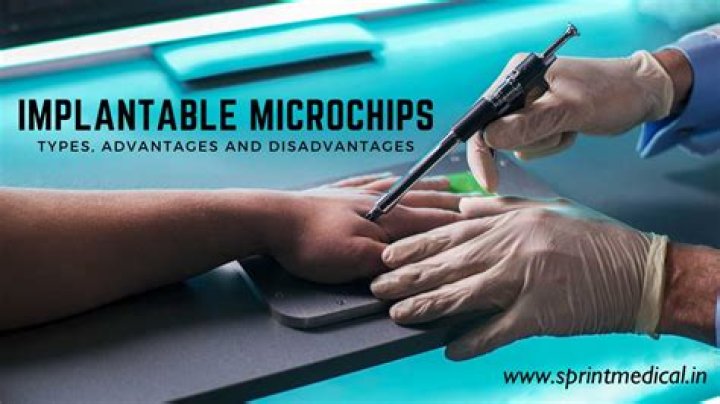 Can a human being be microchipped?