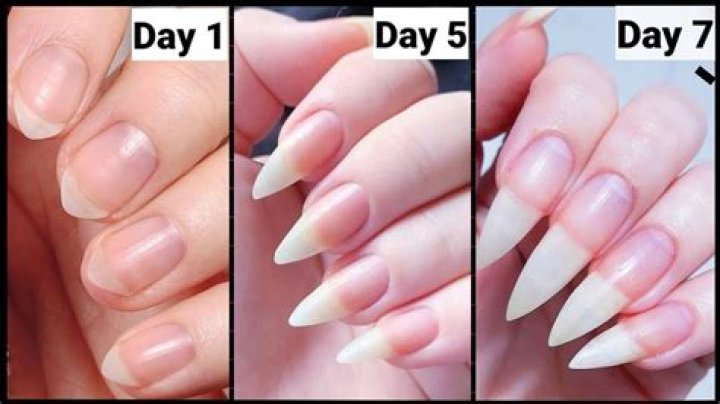 Can you have long nails in dental school?