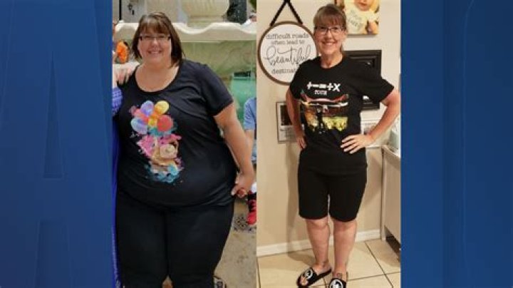 Casey King’s Amazing Weight Loss Journey From 845 lbs to 266 Lbs!