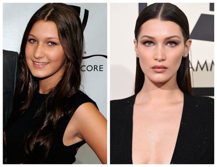 Did Bella Hadid Get a Nose Job? See Before and After Photos of the Model’s Alleged Plastic Surgery!