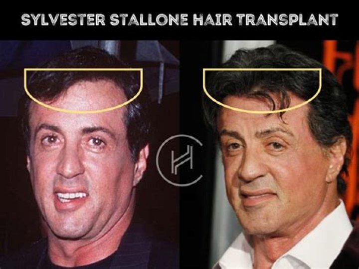 Did Sylvester Stallone have anything to do with Saturday Night Fever?