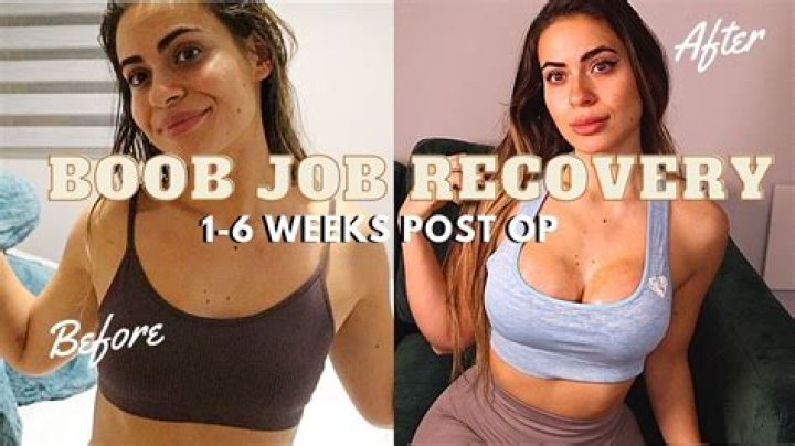 🤨 Diddy Made Cassie Redo Boob Job “Weeks” After Getting It Done, Ex-Bodyguard Alleges