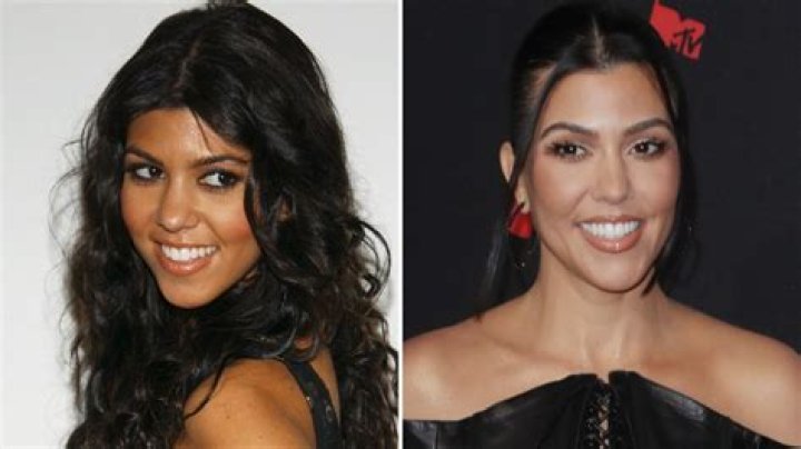 Everything Kourtney Kardashian Has Said About Plastic Surgery: Photos of the ‘KUWTK’ Alum Then and Now