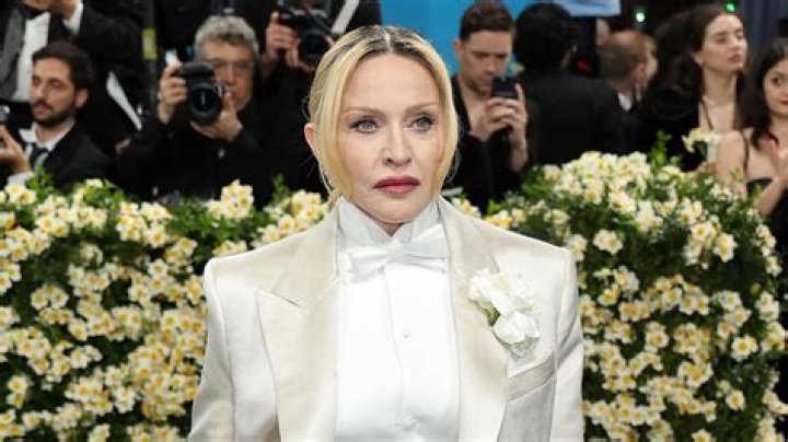 Fans Are Loving Madonna’s New Look — Which May Be Due to a Popular Facial Procedure!