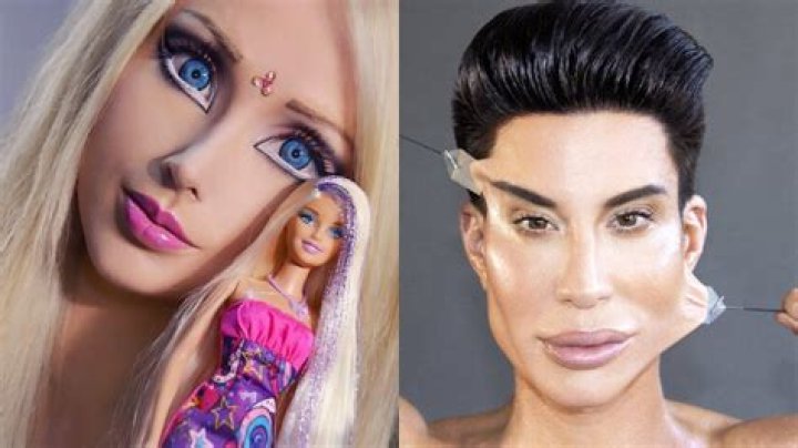 Human Ken Doll Rodrigo Alves Celebrates His Birthday With His 10th Nose Job and Cat Eye Lift!