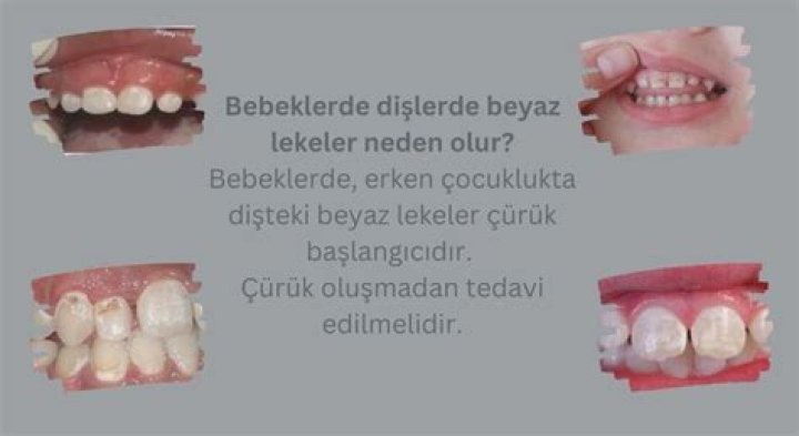 İdrarımda neden beyaz ipliksi şeyler var?