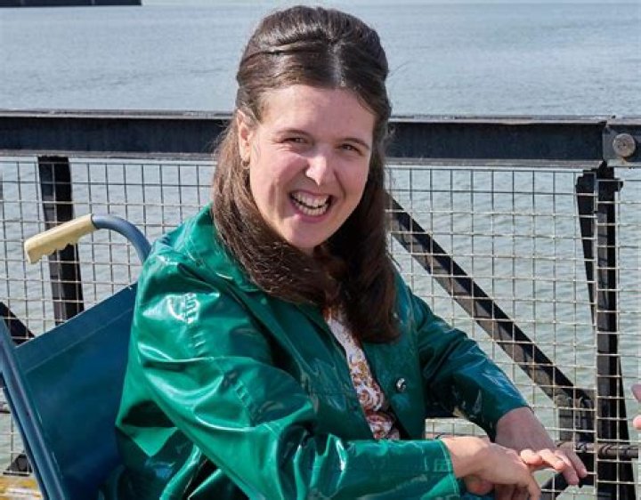 Is baby Susan in Call the Midwife really disabled?