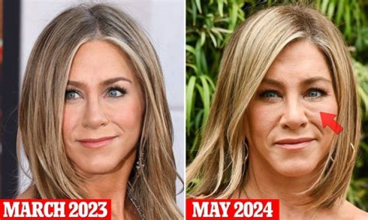 Jennifer Aniston Eye Color: Did She Undergo With Face Lift?