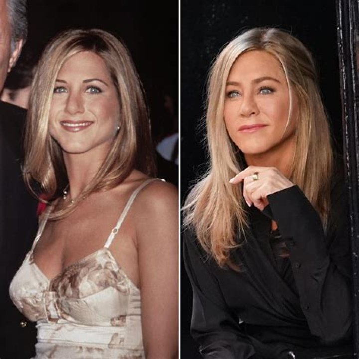Jennifer Aniston Has Been Open About Her Plastic Surgery — Learn What Procedures She’s Had
