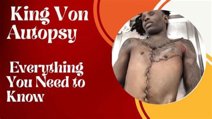 King Von's Sister Exposes Man Who Allegedly Leaked Autopsy Picture