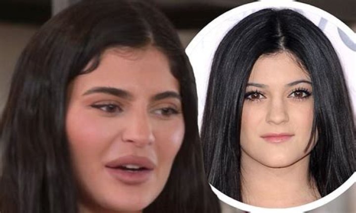 Kylie Jenner’s Changing Face: 10 Instagram Pics That Look Nothing Like Her