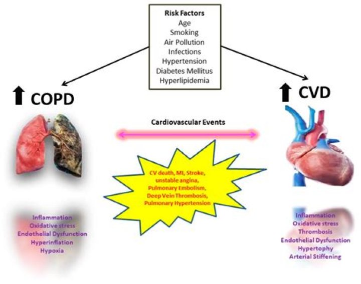 Megan Bhari Death: Died From Heart Failure Associated With Her Fatty Liver