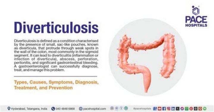 What are four complications of diverticulitis?