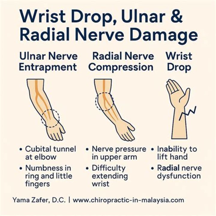 What can cause nerve damage in wrist?