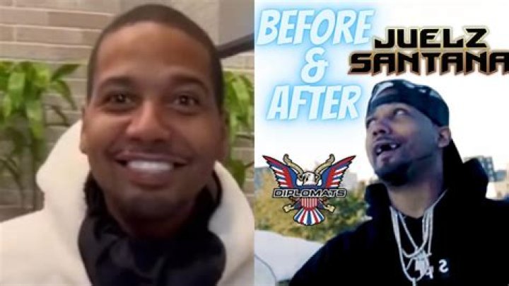 What Happened To Juelz Santana Teeth? Update