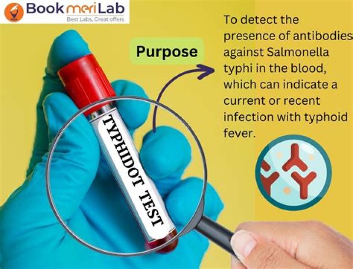 What is the purpose of JP 1?