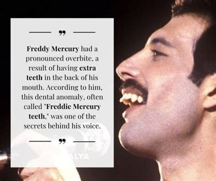 What’s up with Freddie Mercury’s teeth? – Celebrity.fm – #1 Official Stars, Business & People Network, Wiki, Success story, Biography & Quotes