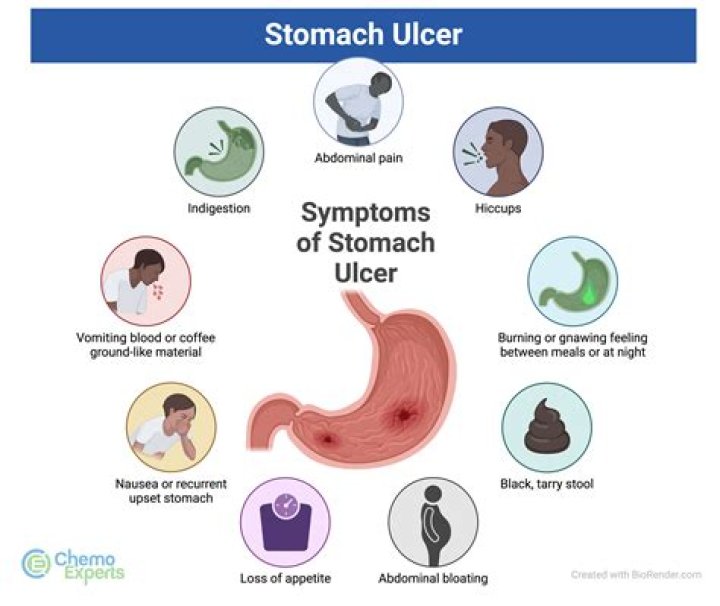 What triggers ulcer?