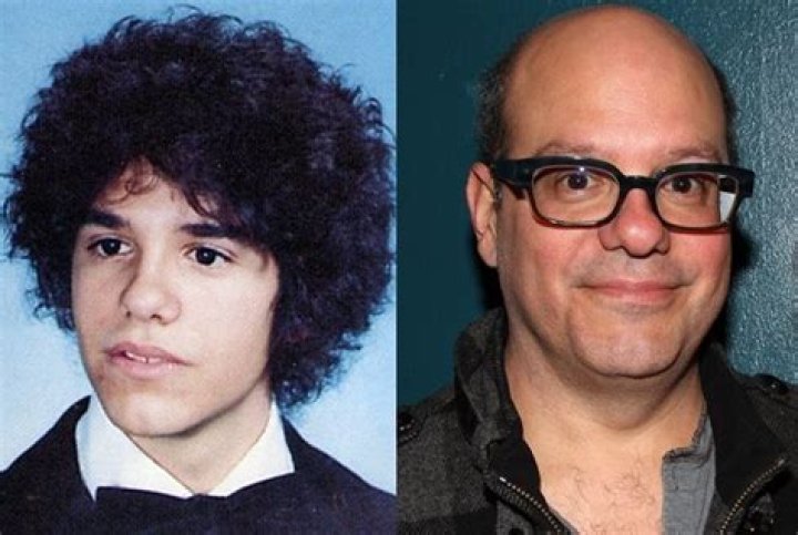 When did David Cross lose his hair?